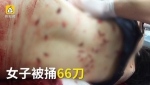 郑州一女子拒已婚男表白遭报复 被刺66刀（图） - 河南一百度