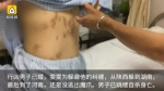 郑州一女子拒已婚男表白遭报复 被刺66刀（图） - 河南一百度