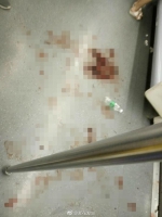 郑州地铁一号线惊魂一幕：20多岁小伙吐血昏厥 - 河南一百度