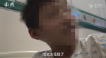11岁大脚娃来郑州做手术 为省钱不用200元镇痛泵 - 河南一百度
