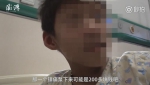 11岁大脚娃来郑州做手术 为省钱不用200元镇痛泵 - 河南一百度