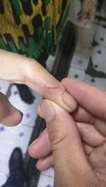 扩散急寻！郑州女子被老鼠咬伤手指出血，干急找不到疫苗 - 河南一百度