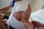 郑州一工人胸口被钢管刺出“大窟窿”，医生却说是不幸中的万幸 - 河南一百度