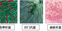 餐饮企业食堂餐具碗筷如何解决消毒杀菌和大肠杆菌超标的问题 - 郑州新闻热线