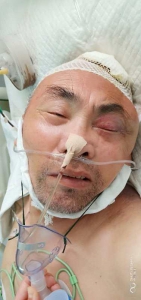 急寻家属!郑州一男子被撞伤在ICU治疗，至今意识不清 - 河南一百度
