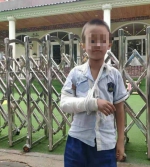 郑州6岁男孩子在幼儿园摔骨折，家长向园方讨说法 - 河南一百度