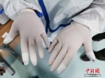　8月19日，郑州人民医院核酸检测实验室工作人员展示贴有创可贴的双手，其手指因频繁地拧样本瓶盖导致破皮。据介绍，该实验室日均检测标本超万份，高峰期日检测标本达2.3万份。 中新社记者 韩章云 摄 - 中国新闻社河南分社