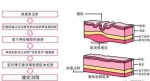 佛山凯瑟琳整形—带你认识什么是“肉毒素”？ - 郑州新闻热线